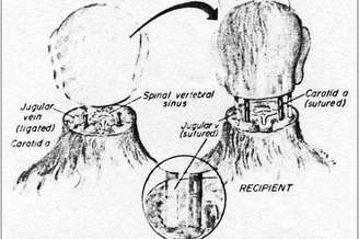 Desenho de transplante de cabeça realizado em um macaco há 40 anos 