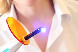 Uma pesquisa da Faculdade de Odontologia de Ribeirão Preto (FORP) da USP mostrou resultados favoráveis no uso de laser para a prevenção de cárie radicular (na raiz dos dentes)