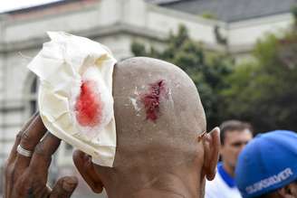 <p>Morador mostra ferimento causado durante o tumulto</p>