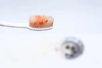 Bactérias da boca podem entrar na corrente sanguínea pela gengiva inflamada e se alojar nas articulações