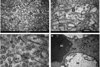 O genoma do vírus Zika, coletado no organismo de mosquitos do gênero Culex, foi sequenciado por cientistas da Fundação Oswaldo Cruz em Pernambuco