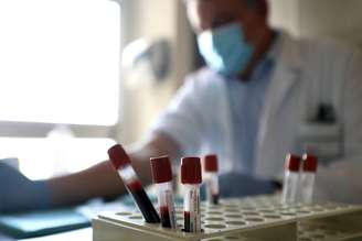 Testes com anticorpos mostraram bons resultados contra a Covid-19