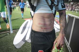 Guga saiu de campo com marcas no corpo e reclamando de uma agressão-(Pedro souza/Atlético-MG)