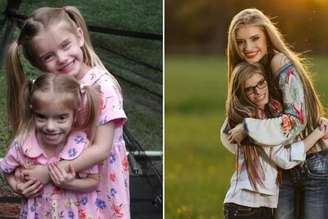 Guinness Book: gêmeas idênticas mais diferentes vão para o livro dos recordes