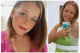 Barbara deu início ao processo de protetização e quer agora inspirar outras pessoas