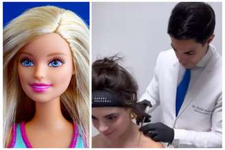 Boneca "Barbie" à esquerda; à direita, Gkay durante aplicação de botox no trapézio