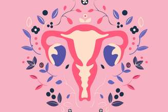 A endometriose afeta cerca de 176 milhões de mulheres no mundo