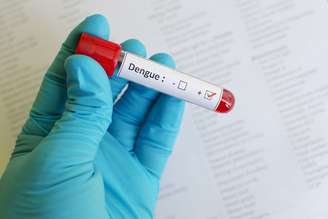 Exame que detecta dengue