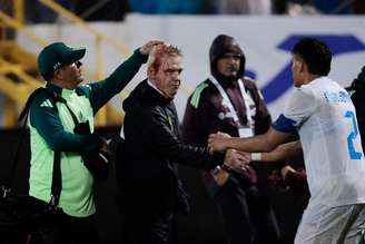 Javier Aguirre, técnico do México, foi ferido na cabeça com uma garrafa após jogo contra Honduras