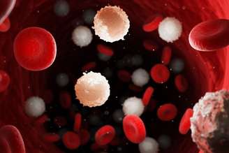 A leucemia é um câncer comum