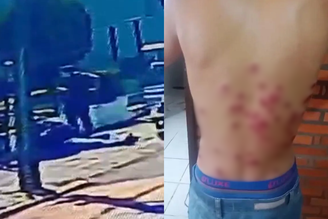 Motociclista leva tiro de bala de borracha e é espancado em abordagem de guardas municipais no RS