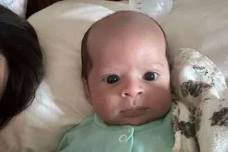 Bebê "calvo" viralizou nas redes sociais e gerou comentários engraçados