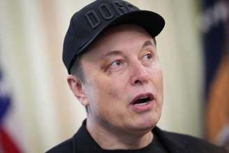 Musk com olho roxo em evento na Casa Branca - 30/05/2025