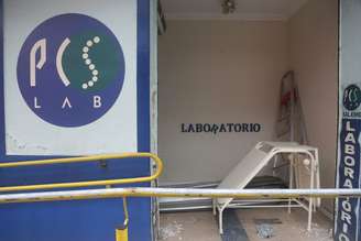 Falha em exames realizados pelo PCS Lab levaram aos erros nos transplantes, segundo o MPRJ