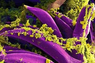 Representação artística da bactéria Yersinia pestis, causadora da peste