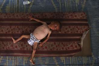 25% das crianças em Gaza sofrem com desnutrição, diz MSF