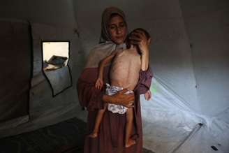 Mãe segura bebê de 18 meses com sinais de desnutrição em campo de refugiados em Gaza