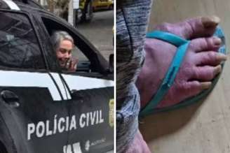 Rejane Schumann em viatura | Pé de Rejane Schumann