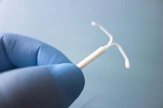 Dispositivo intrauterino (DIU)
