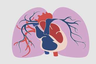 A hipertensão arterial pulmonar é uma doença rara e grave