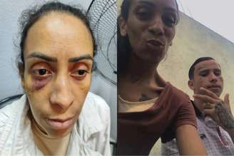 A auxiliar de enfermagem Tatiana Vieira já tinha denunciado a agressão e conseguido uma medida protetiva contra o ex, Wesley Palma, principal suspeito do crime