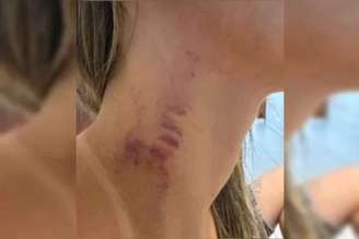 Influencer coloca câmeras em casa e registra agressão brutal do ex - destaque galeria