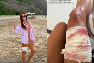 Advogada é mordida por tubarão durante mergulho em Fernando de Noronha e brinca: 'Deve estar sem dente'