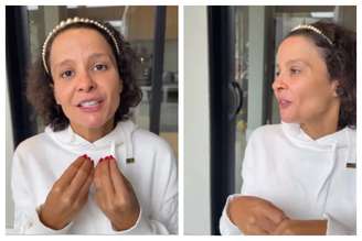 A cantora Maiara fala sobre alopecia