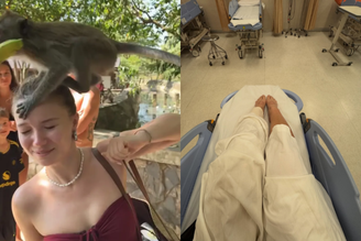 Influenciadora Julia Beautx foi internada após ataque de macacos na Tailândia