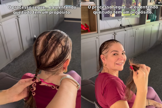 Mãe de Lucas Lucco corta cabelo após diagnóstico de alopecia: 'Dia de desapegar'