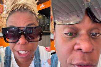 Cacau Protásio mostra olho com cor diferente após quadro de reação alérgica