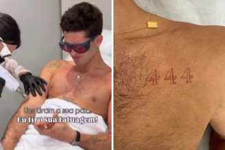 João Guilherme retira tatuagens