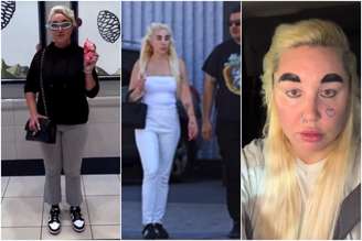 Amanda Bynes  perde 16 quilos