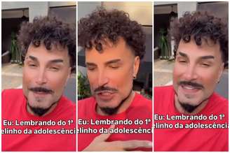 Latino surge irreconhecível após procedimentos no rosto