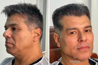 Maurício Mattar, antes e depois