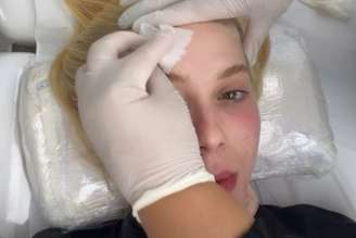 Virginia antes de realizar o procedimento em 2026