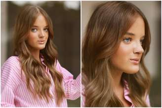 Rafaella Justus mostra resultado de rinoplastia