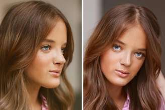 Rafa Justus após segunda cirurgia no nariz