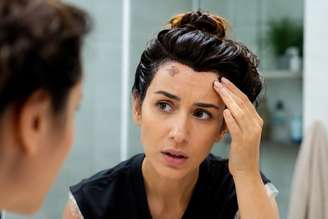 Tingiu o cabelo e manchou a pele? Veja como remover sem sofrimento