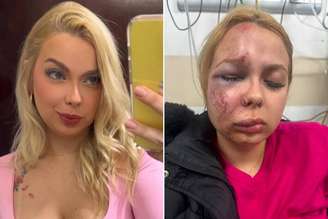 Larissa foi agredida em estação do Metrô de São Paulo