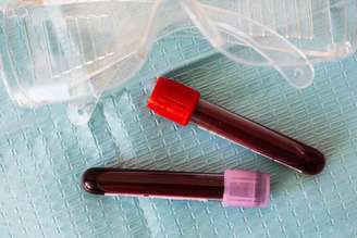 exame de hemoglobina glicada.
