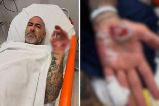 Henrique Fogaça relata acidente de moto e roubo de aliança