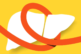Quando não identificadas e tratadas adequadamente, as hepatites podem evoluir para condições mais graves