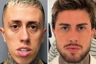 Antes e depois: MC Daniel