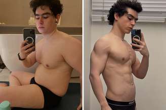 Vitor Fadul, marido de Leandro Karnal, mostra antes e depois