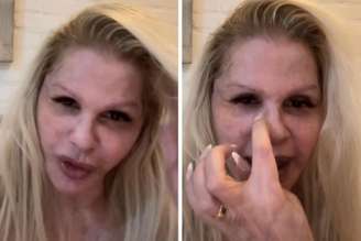 Monique Evans, ex-modelo, interage com seus seguidores e fala sobre procedimento