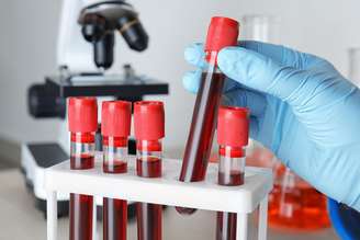 Exame de sangue para Alzheimer pode ajudar a detectar o declínio cognitivo precoce