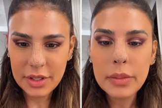Simone Mendes interage com seguidores e fala sobre cirurgia estética 