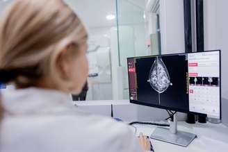 Inteligência artificial pode ajudar na detecção de câncer de mama