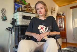 Maria Kovalchuk aparece com cicatriz na testa em entrevista